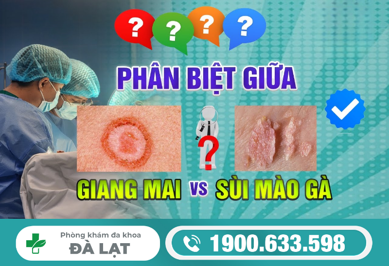 Hình ảnh minh họa